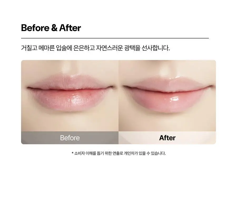 [슬기PICK] 오아드 릴리프 너리싱 립 케어 밤 상세페이지 18